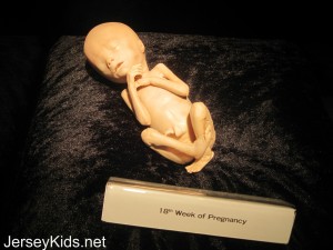 18 week fetus. Copyright Deborah Abrams Kaplan