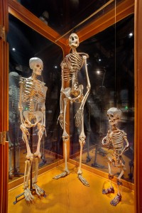 Compare and Contrast: Giant, Dwarf and Average Skeletons George Widman, 2009, for the Mütter Museum of The College of Physicians of Philadelphia 