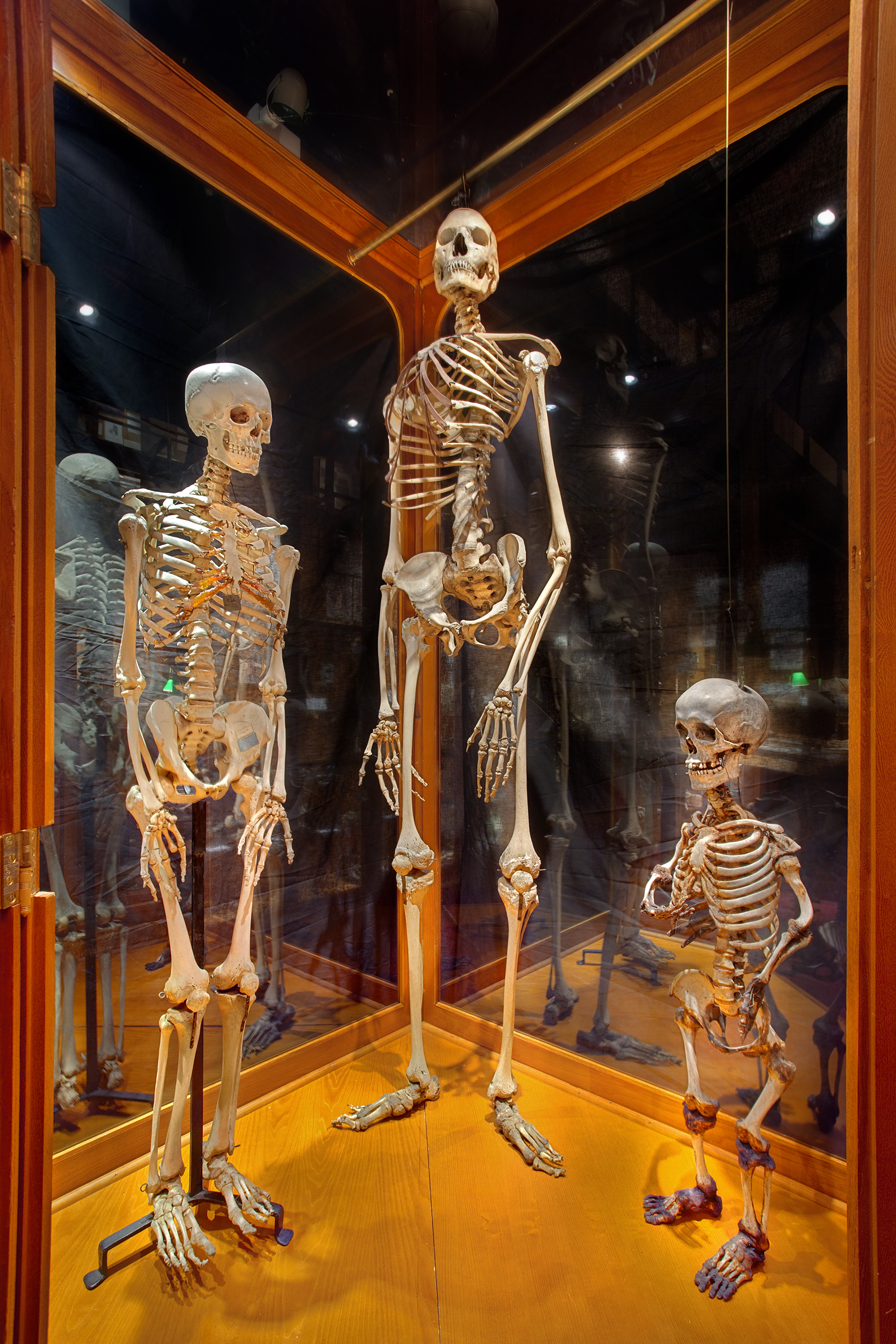 Philadelphia: Mutter Museum with Kids - Jersey Kids